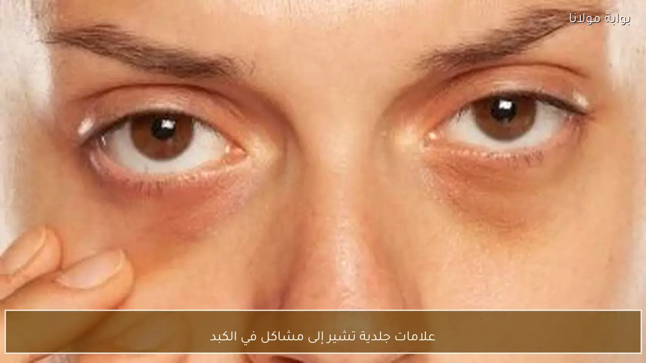 علامات جلدية تشير إلى مشاكل في الكبد