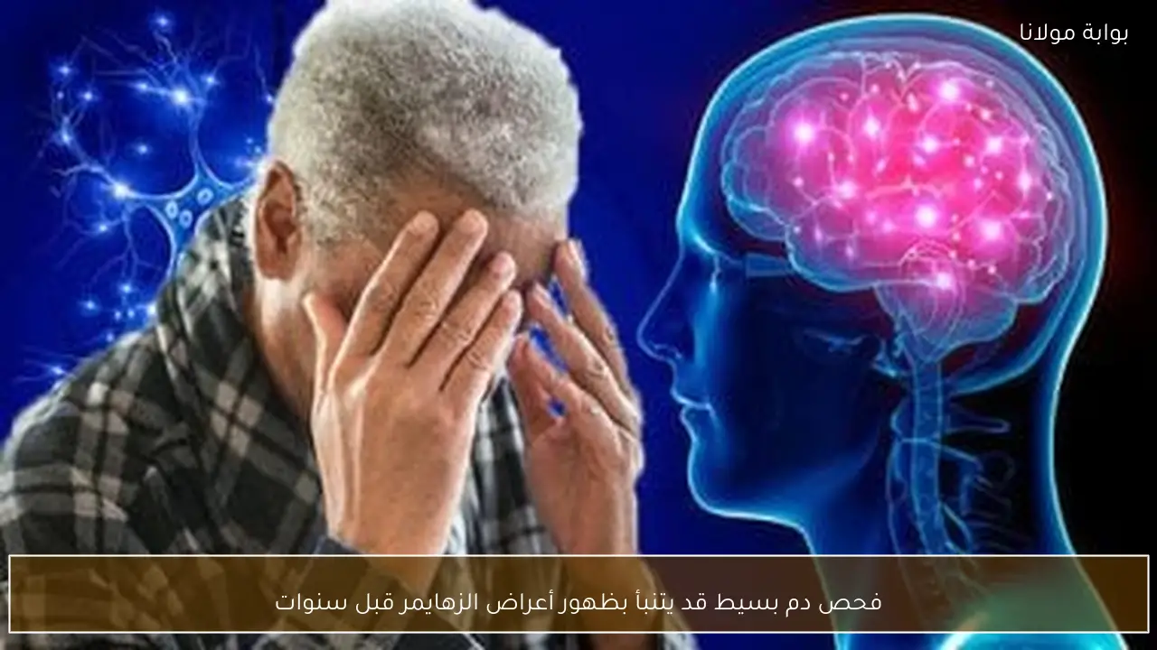 فحص دم بسيط قد يتنبأ بظهور أعراض الزهايمر قبل سنوات