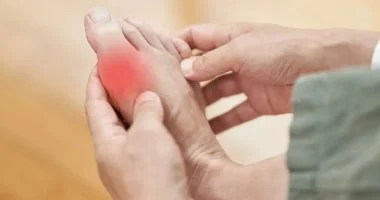 مرض الملوك نوع من التهاب المفاصل يسبب الألم.. شرب الماء ضرورى لتجنبه