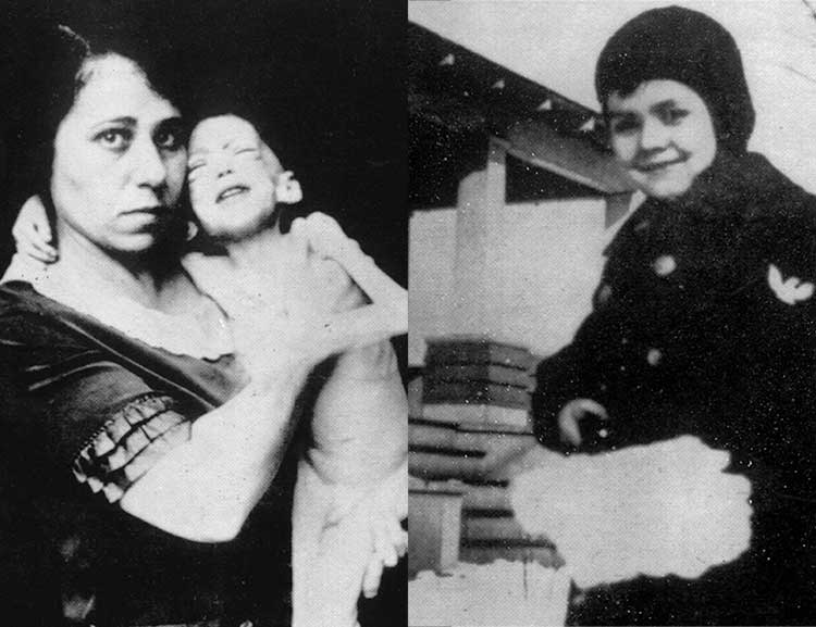 1922_childwithtype1diabetes_before_after