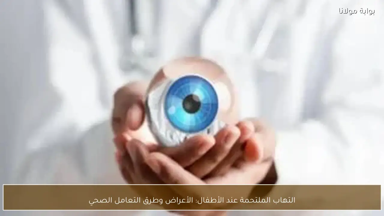 التهاب الملتحمة عند الأطفال: الأعراض وطرق التعامل الصحي