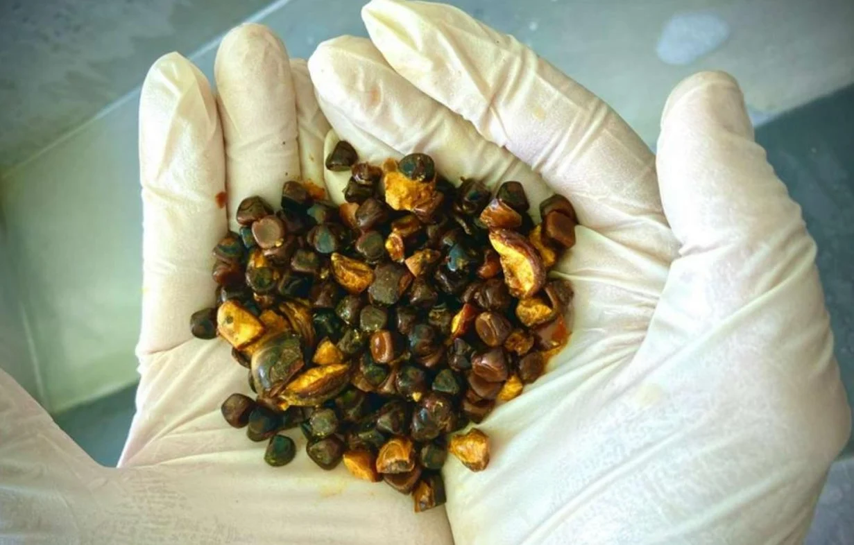 حصى المرارة البقرية الآن أغلى من الذهب حصى المرارة البقرية الآن أغلى من الذهب