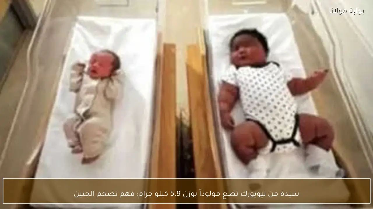 سيدة من نيويورك تضع مولوداً بوزن 5.9 كيلو جرام: فهم تضخم الجنين