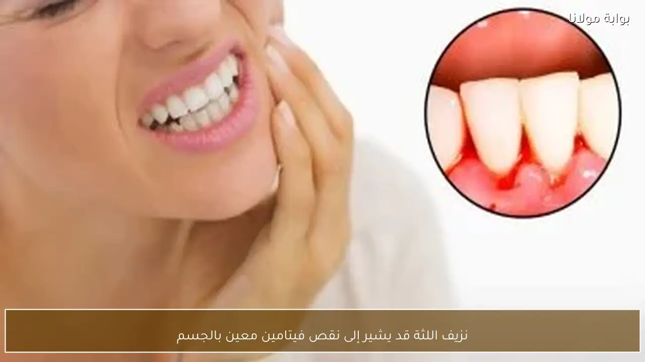 نزيف اللثة قد يشير إلى نقص فيتامين معين بالجسم