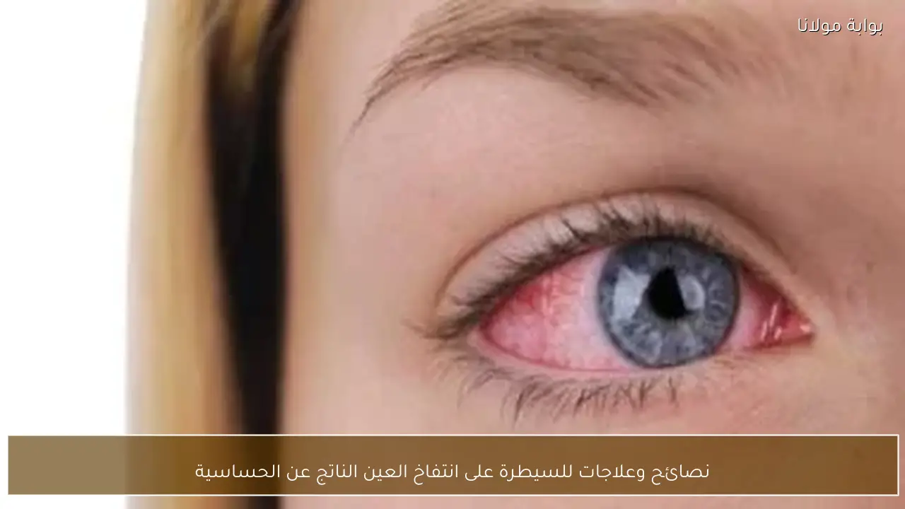 نصائح وعلاجات للسيطرة على انتفاخ العين الناتج عن الحساسية