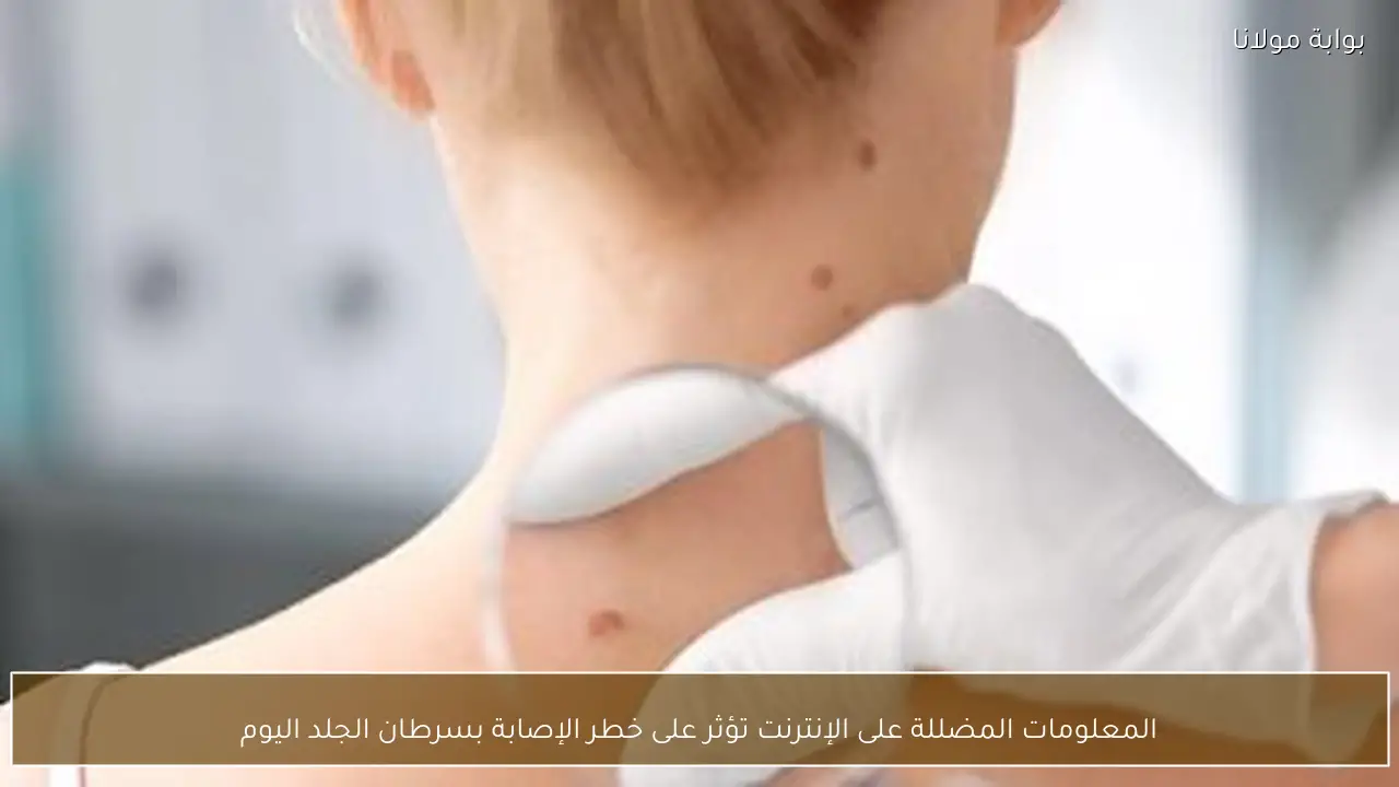 المعلومات المضللة على الإنترنت تؤثر على خطر الإصابة بسرطان الجلد اليوم
