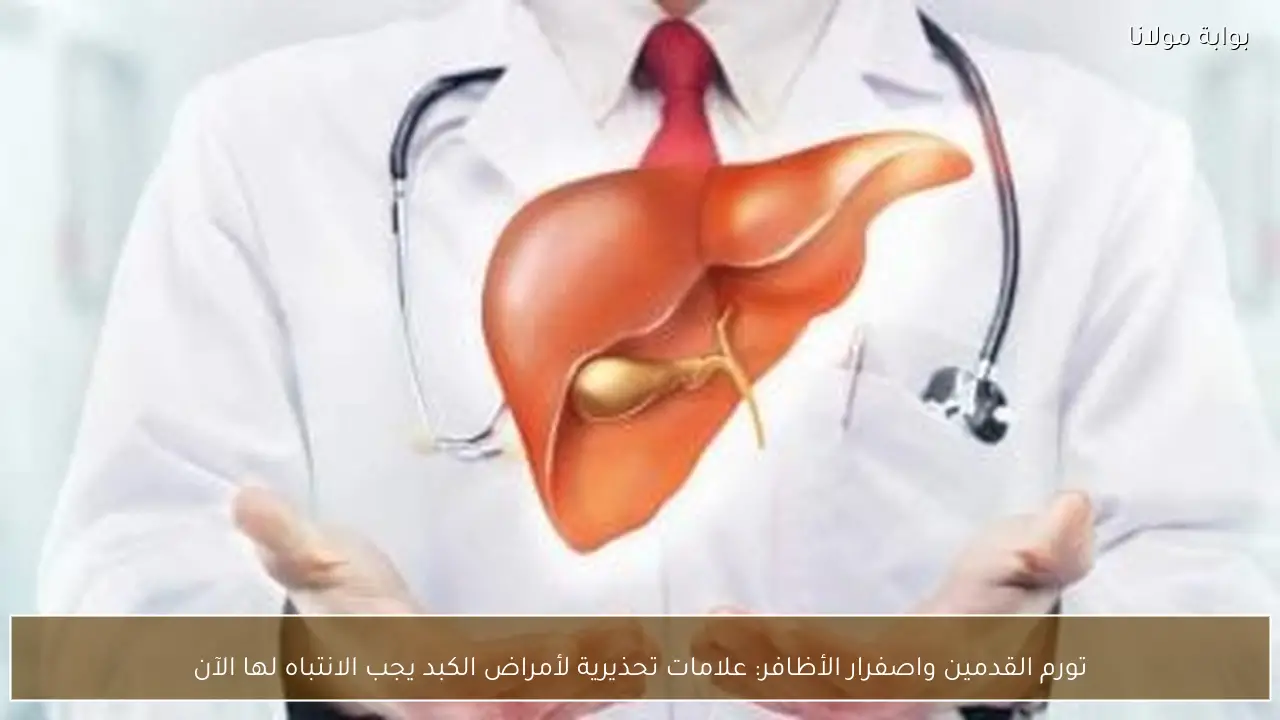 تورم القدمين واصفرار الأظافر: علامات تحذيرية لأمراض الكبد يجب الانتباه لها الآن
