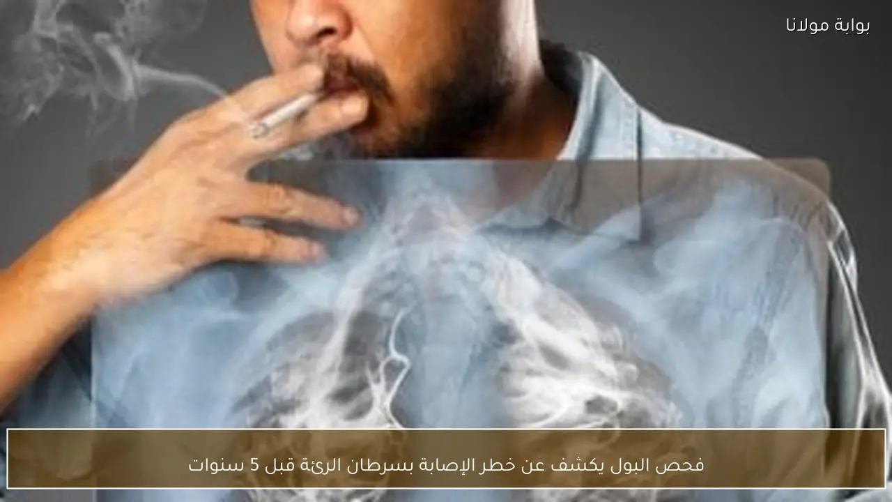 فحص البول يكشف عن خطر الإصابة بسرطان الرئة قبل 5 سنوات