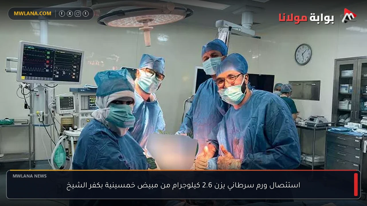 استئصال ورم سرطاني يزن 2.6 كيلوجرام من مبيض خمسينية بكفر الشيخ