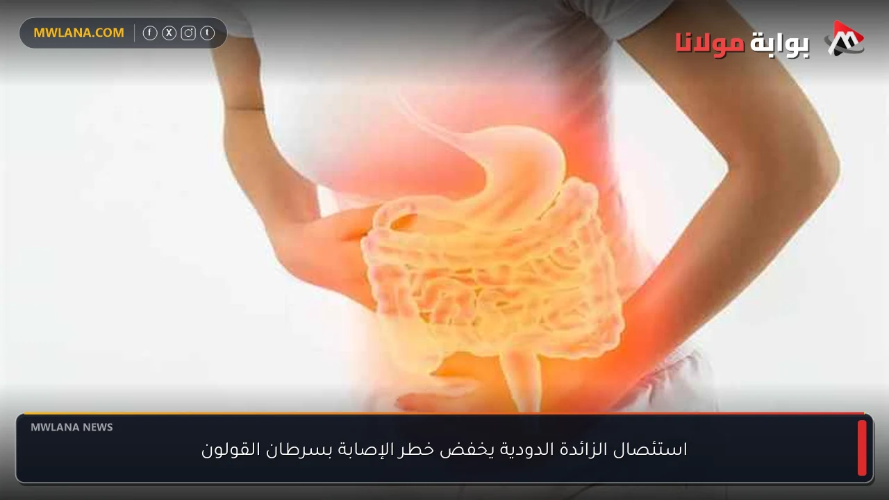 استئصال الزائدة الدودية يخفض خطر الإصابة بسرطان القولون
