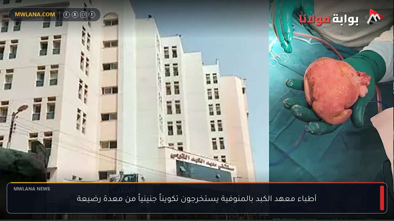 أطباء معهد الكبد بالمنوفية يستخرجون تكويناً جنينياً من معدة رضيعة